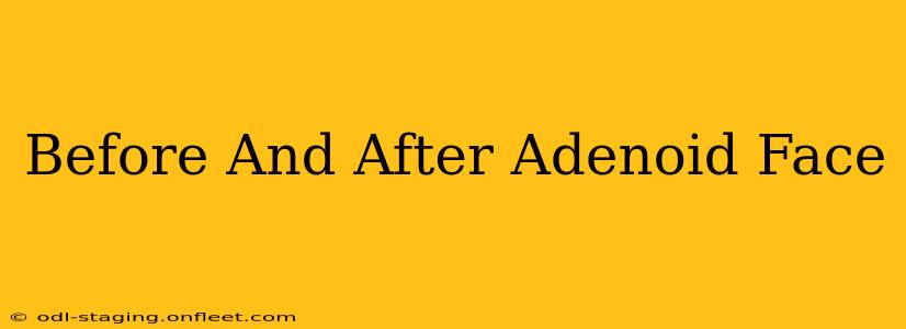 Before And After Adenoid Face